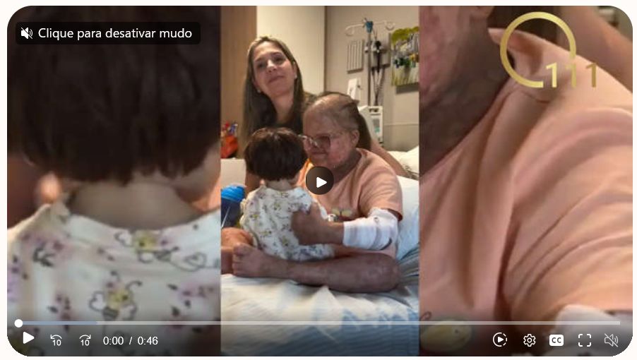 Relato apresenta o caso de uma menina diagnosticada com a rara síndrome de Rothmund-Thomson.