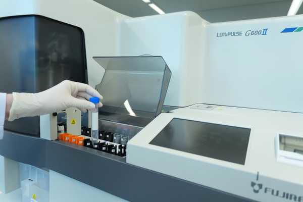Novo exame de sangue com registro na Anvisa mede a proteína p-tau217 e pode auxiliar na investigação de pacientes com