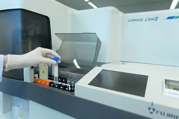 Novo exame de sangue com registro na Anvisa mede a proteína p-tau217 e pode auxiliar na investigação de pacientes com suspeita de Alzheimer.
