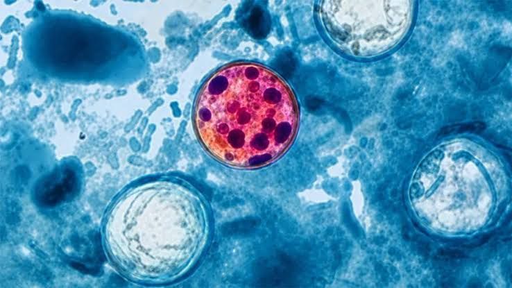 Surto de ciclosporíase nos Estados Unidos acendeu alerta para contaminação por alimentos e água.